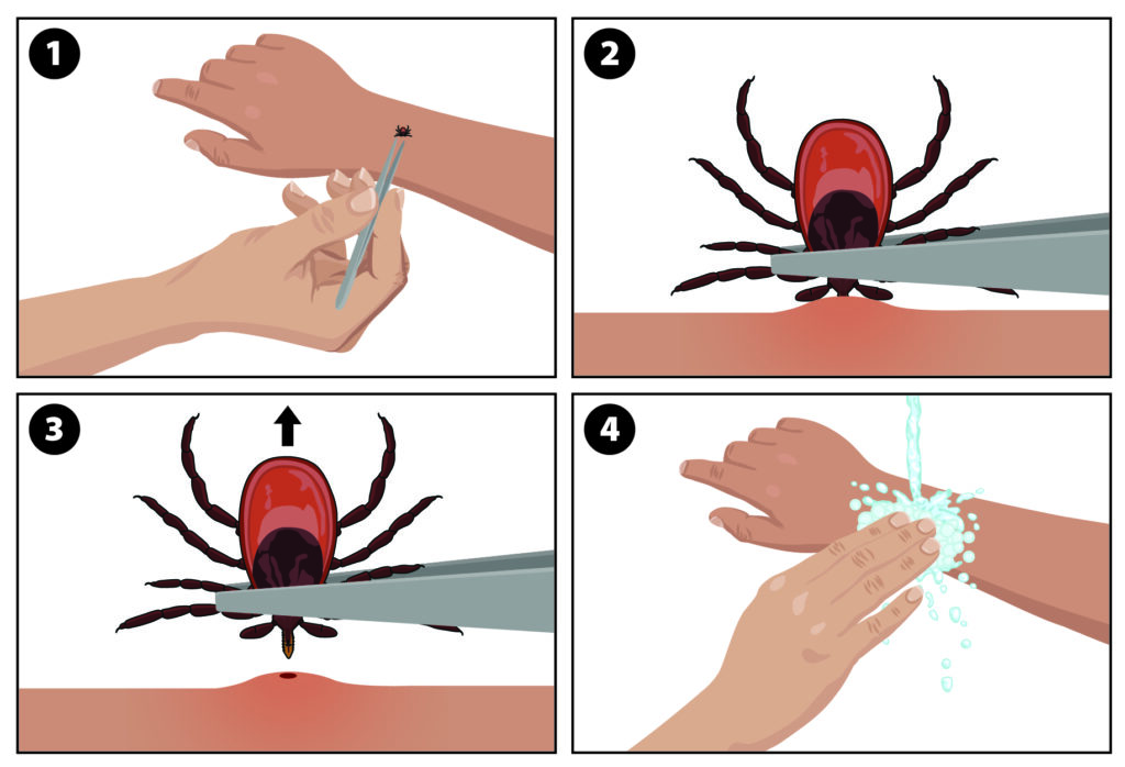 18_293708_tick_removal_rectangle_print